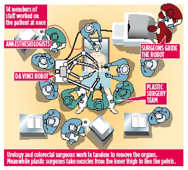 The astonishing procedure, involving 14 surgeons, was carried out in July on a married father-of-one with advanced rectal cancer.&nbsp;Pictured: An illustration of the procedure